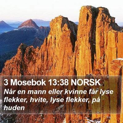 3 Mosebok 13:38 NORSK Bible Verse Image